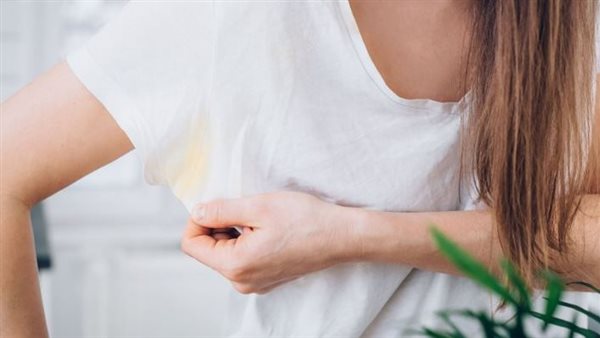 بقع الملابس الصفراء