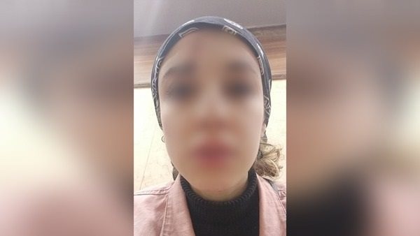 الفتاة التى تعرضت