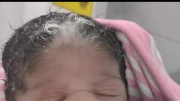 الطفلة المولودة