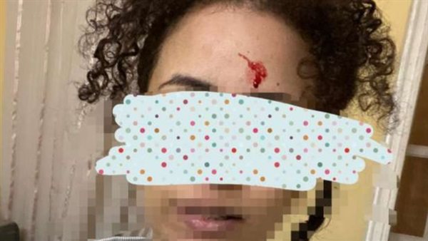 صورة أحد الضحايا