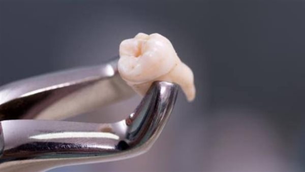 تفسير حلم سقوط الأسنان