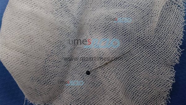 الدبوس بعد استخراجه