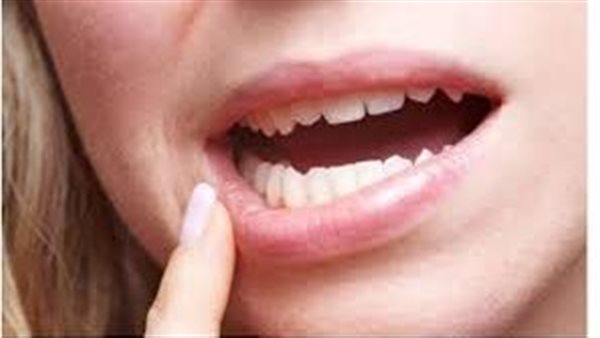 تفسير حلم سقوط الأسنان