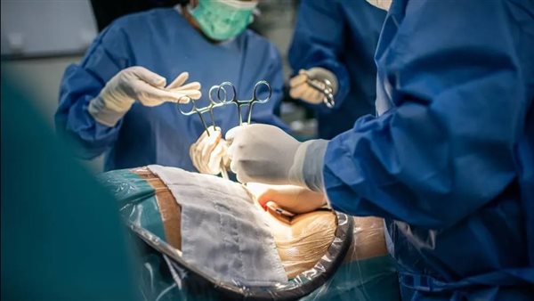 الولادة القيصرية