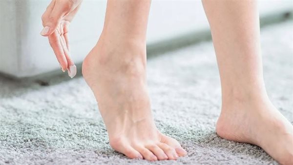 تشقق الكعبين في الصيف