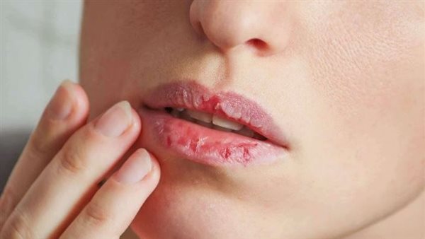 ترطيب الشفاه 