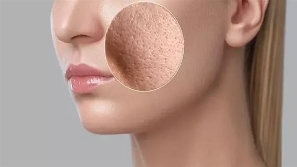 المسامات الواسعة