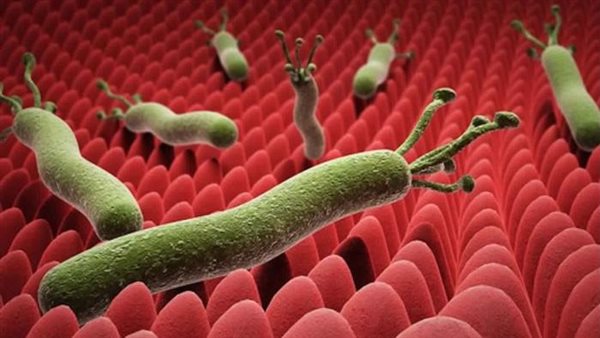 جرثومة المعدة وأعراضها