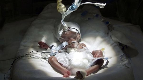 ازمة صحية تهدد حياة