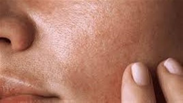 تحذيرات لوصفات قد