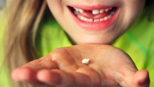 تفسير حلم سقوط الأسنان