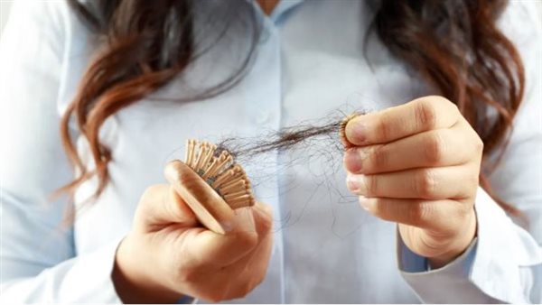تساقط الشعر 