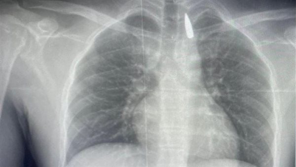 حالة المصاب 