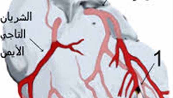 شكل شريان التاجي