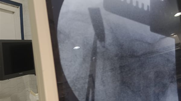 صورة من الاشعة للطبيب