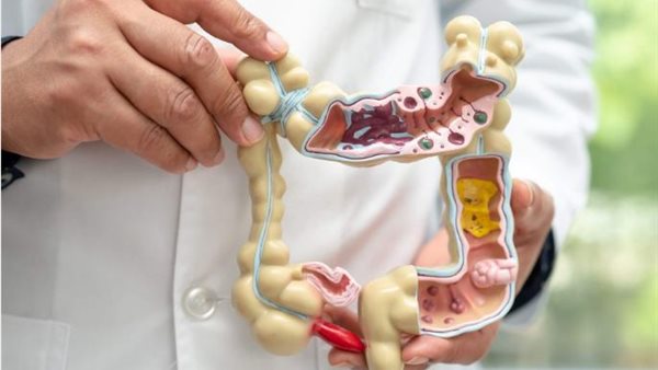 القولون العصبي 