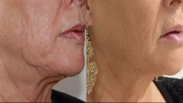 الإفتاء تجيز إجراء