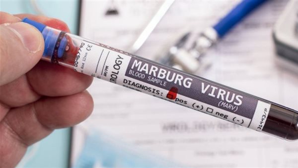 فيروس ماربورغ 