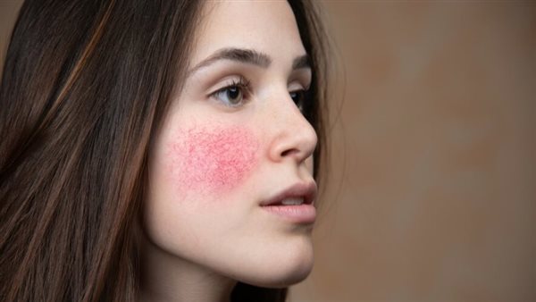 الكورتيزول 