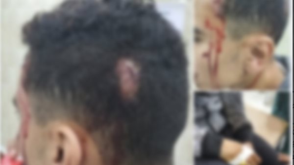 صورة للمجنى عليه