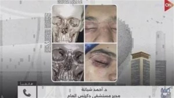 إصابة بالوجه والفكين