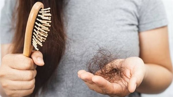 تساقط الشعر