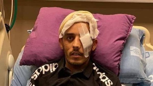 الجريح الفلسطيني