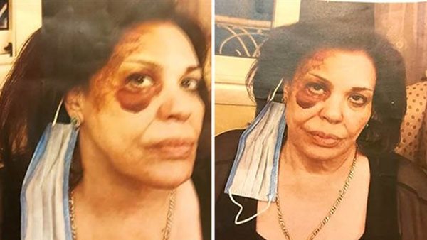 فادية الصباحى