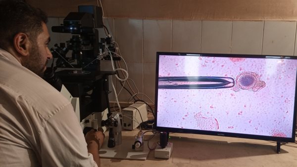 جهاز الحقن المجهرى