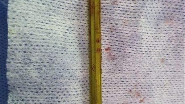 صورة من الحدث