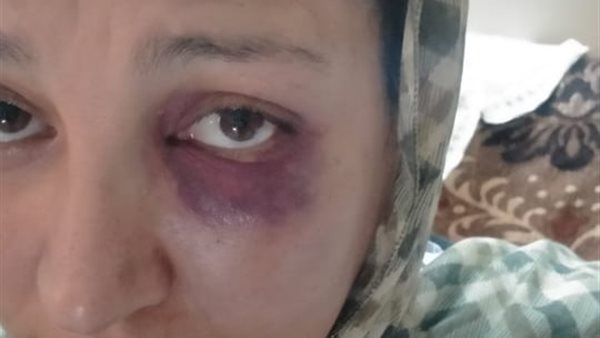 المجني عليها 