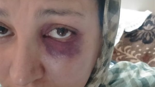 المجنى عليها 